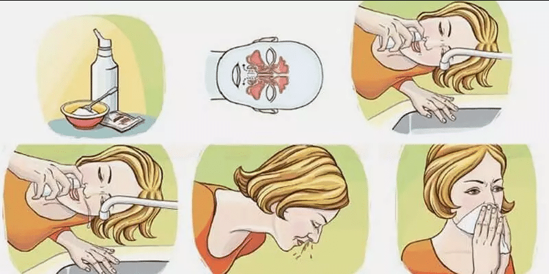 Як правильно промивати ніс сольовим розчином