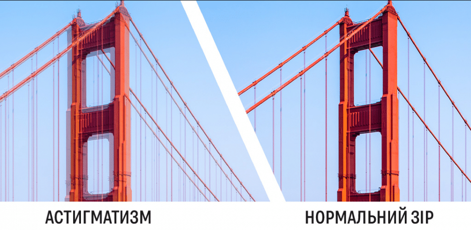 Що таке астигматизм?