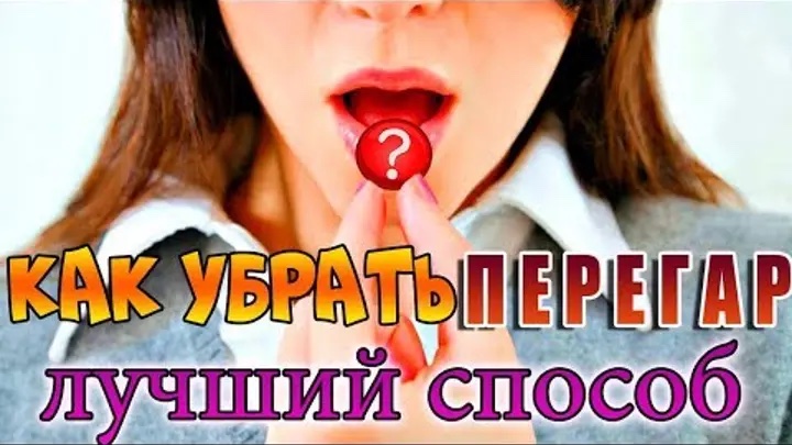 Як позбутись перегару